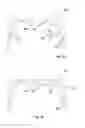 Fig. 05 - Membrane, and a neck including such membrane