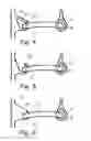 Fig. 03 - Container with sub-chambers separated by peelable seal