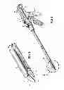 Fig. 02 - Dissecting tip for surgical stapler