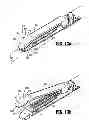 Fig. 22 - Dissecting tip for surgical stapler