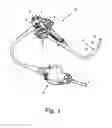 Fig. 02 - STAPLER FOR ENDOSCOPES