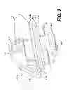 Fig. 10 - Anchor