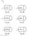 Fig. 03 - Apparatus, system and method for shaping a valve orifice