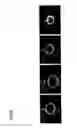 Fig. 06 - Dried hydrogel, dried vitrigel membrane, and methods for producing the same