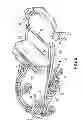 Fig. 03 - Foldable walking stabilizer device