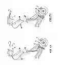 Fig. 09 - Foldable walking stabilizer device