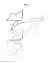 Fig. 07 - Small overlap frontal impact countermeasure