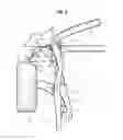 Fig. 10 - Small overlap frontal impact countermeasure