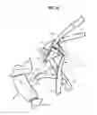 Fig. 13 - Small overlap frontal impact countermeasure
