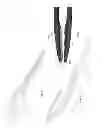 Fig. 04 - TONGS WITH TEETH