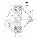 Fig. 03 - Orbital motor and generator