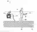 Fig. 01 - Sonde devices including a sectional ferrite core