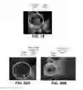 Fig. 22 - Virtual Fixtures for Improved Performance in Human/Autonomous Manipulation Tasks