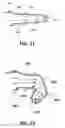 Fig. 07 - MANIPULATING, CAPTURING, AND CONSTRAINING MOVEMENT