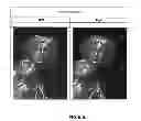 Fig. 07 - Antighosting method using binocular suppression