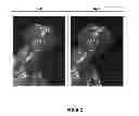 Fig. 08 - Antighosting method using binocular suppression