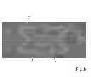 Fig. 07 - Method, ophthalmic measuring system and computer-readable storage medium for selecting an intraocular lens