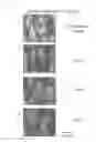 Fig. 06 - Methods for fabrication of stable ultra-low reflective surface and the ultra-low reflective surface itself