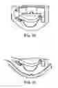 Fig. 22 - Head mounted display having alignment maintained via structural frame