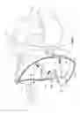 Fig. 08 - Head mounted display with micro-display alignment mechanism