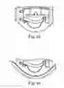 Fig. 22 - Head mounted display with micro-display alignment mechanism