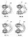 Fig. 07 - Magnetically Contained Energized Plasma