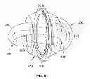 Fig. 08 - Magnetically Contained Energized Plasma