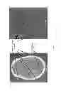 Fig. 04 - Device for externally marking the location of organs on skin during a cat scan