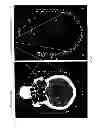 Fig. 06 - Device for externally marking the location of organs on skin during a cat scan