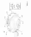 Fig. 10 - Methods of operating a rotary blood pump