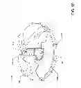 Fig. 11 - Methods of operating a rotary blood pump