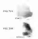 Fig. 22 - SPECIFIC BINDING PROTEINS AND USES THEREOF