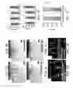 Fig. 06 - Methods of regulating angiogenesis by administering agents which increase apoB-100 polypeptide
