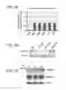 Fig. 07 - Methods of regulating angiogenesis by administering agents which increase apoB-100 polypeptide
