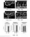Fig. 22 - Methods of regulating angiogenesis by administering agents which increase apoB-100 polypeptide