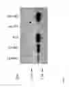 Fig. 06 - Second generation virus-like particles (VLP) from Epstein-Barr viruses for vaccination purposes