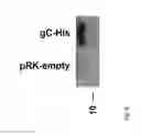 Fig. 09 - Second generation virus-like particles (VLP) from Epstein-Barr viruses for vaccination purposes