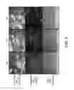 Fig. 08 - Modulation of Tissue Transglutaminase Activation in Disease