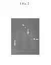Fig. 03 - METHODS, COMPOSITIONS AND DEVICES UTILIZING STINGING CELLS/CAPSULES FOR CONDITIONING A TISSUE PRIOR TO DELIVERY OF AN ACTIVE AGENT