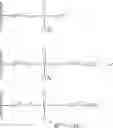 Fig. 87 - Alpha-aminoamidine polymers and uses thereof