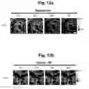 Fig. 18 - hTRPA1-activating composition and use thereof
