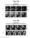 Fig. 21 - hTRPA1-activating composition and use thereof