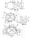 Fig. 06 - Method for producing composite laminates using a collapsible mandrel
