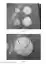 Fig. 02 - DEGRADABLE CHEWING GUM AND METHOD OF MAKING THE SAME