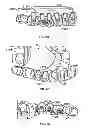 Fig. 05 - Systems and methods for fabricating a dental template
