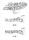 Fig. 06 - Systems and methods for fabricating a dental template
