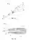 Fig. 08 - Method and device for causing tooth movement