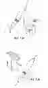 Fig. 16 - Method and device for causing tooth movement