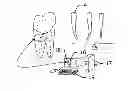 Fig. 01 - Method and system for establishing the shape of the occlusal access cavity in endodontic treatment