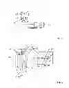 Fig. 03 - Method and system for establishing the shape of the occlusal access cavity in endodontic treatment